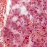 Hipofízisből készült metszet