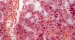 Hipofízisből készült metszet