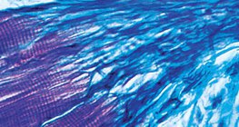 A vázizom és az ín kapcsolata