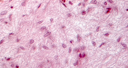 Hipofízisből készült metszet