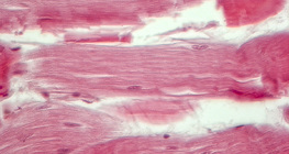 Ínszövet (hosszmetszet)