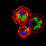 Ecetmuslica vérsejtjei (pirosra festve) bekebelezték a baktériumokat (zöldre festve)