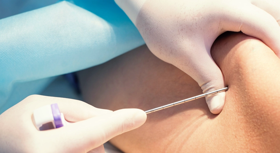 Bone marrow biopsy