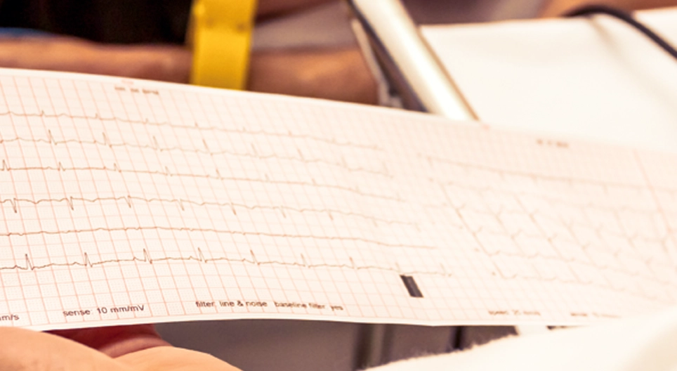 Az EKG működése, hasznosítása, elvezetések