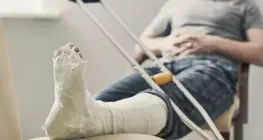Bone fractures