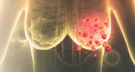 Emlődaganatos kezeléssel kapcsolatos gyakorlati fizioterápiás vonatkozások