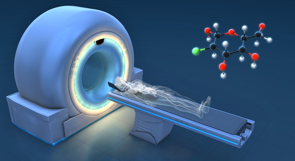 Zasada działania PET-CT