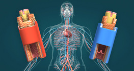 Цусны судас