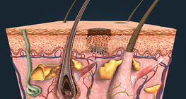 Борлох, арьсны хавдар