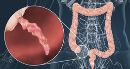 Мухар олгой