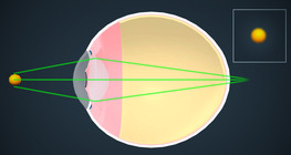 Хараа засах
