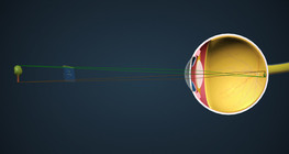 Харааны механизм