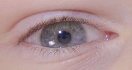 Le réflexe pupillaire